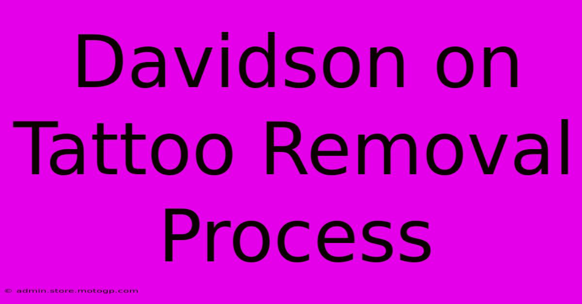 Davidson On Tattoo Removal Process