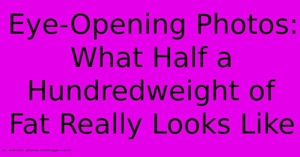 Eye-Opening Photos: What Half A Hundredweight Of Fat Really Looks Like