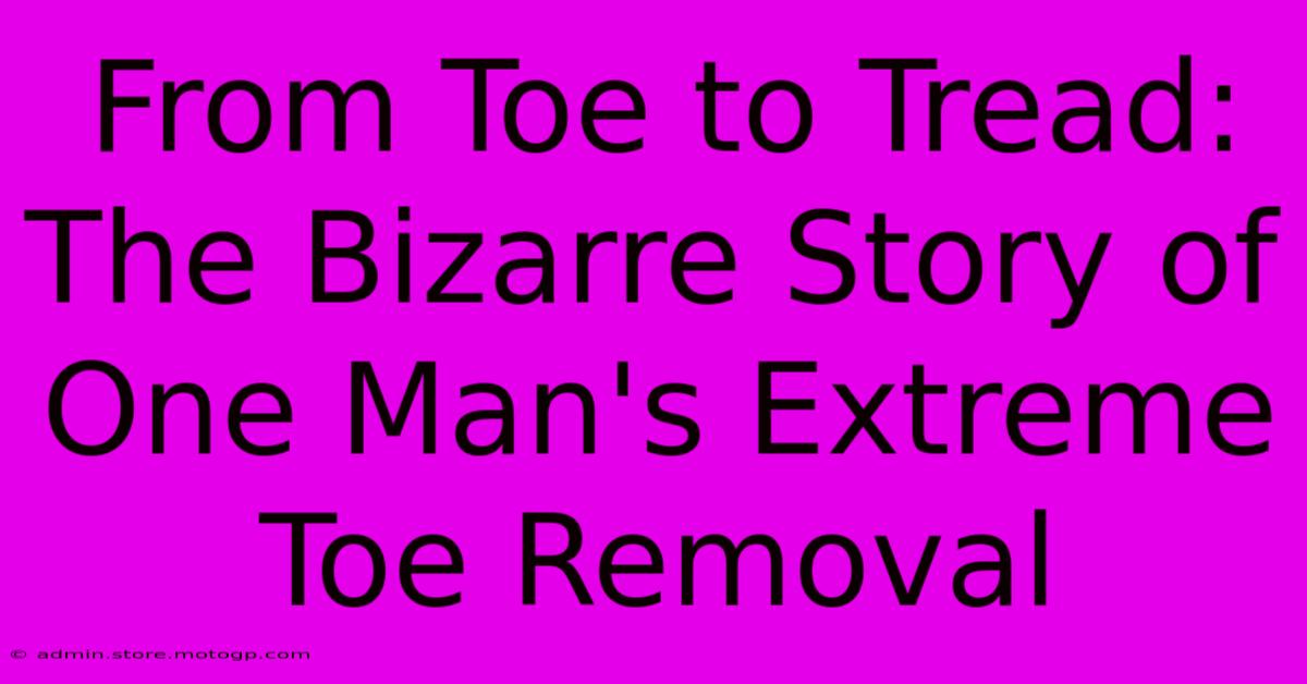 From Toe To Tread: The Bizarre Story Of One Man's Extreme Toe Removal