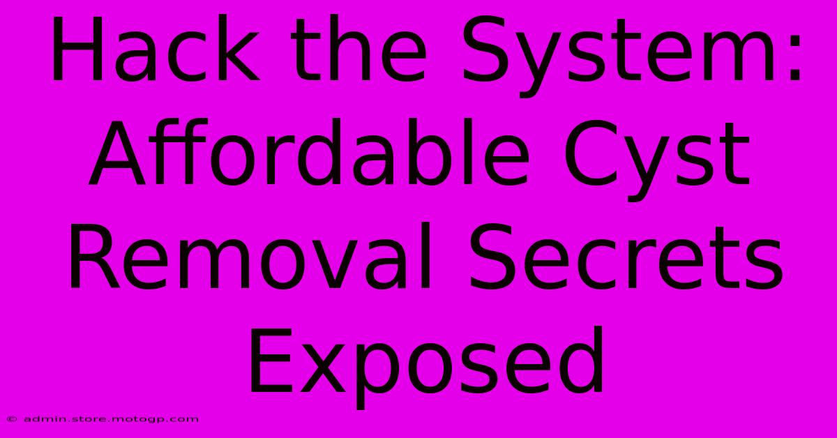 Hack The System: Affordable Cyst Removal Secrets Exposed