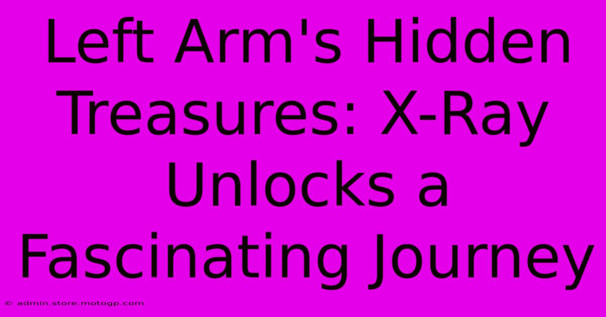 Left Arm's Hidden Treasures: X-Ray Unlocks A Fascinating Journey