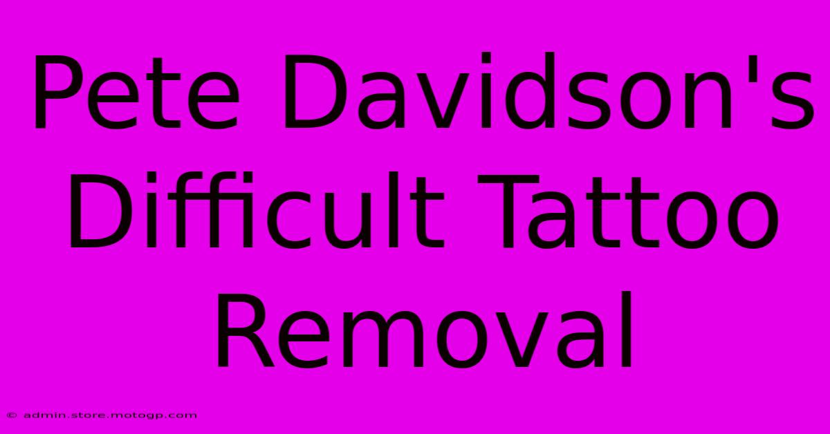 Pete Davidson's Difficult Tattoo Removal