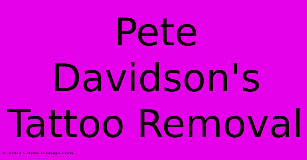 Pete Davidson's Tattoo Removal