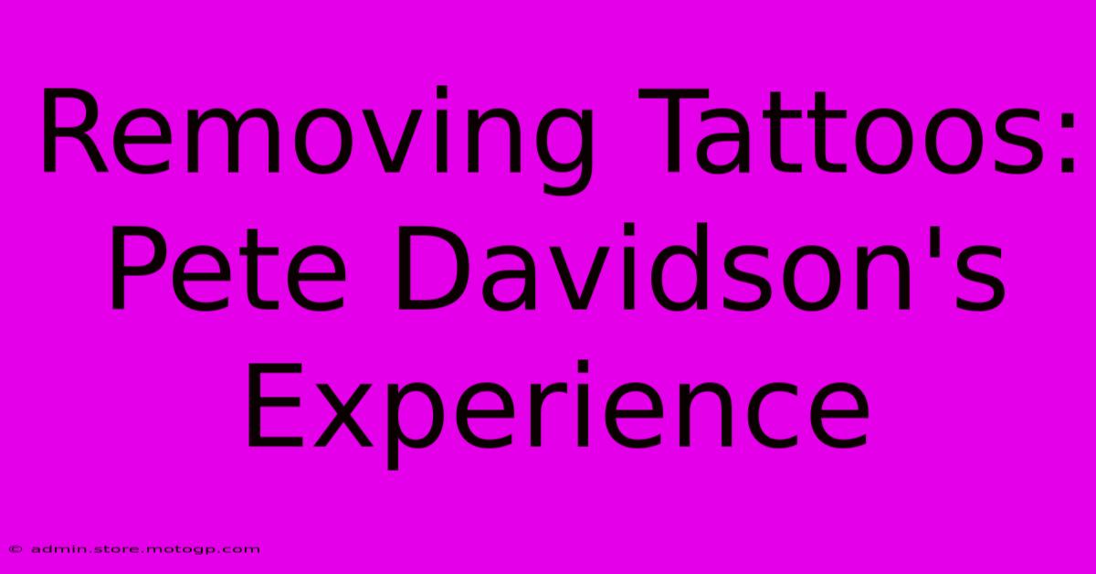 Removing Tattoos: Pete Davidson's Experience