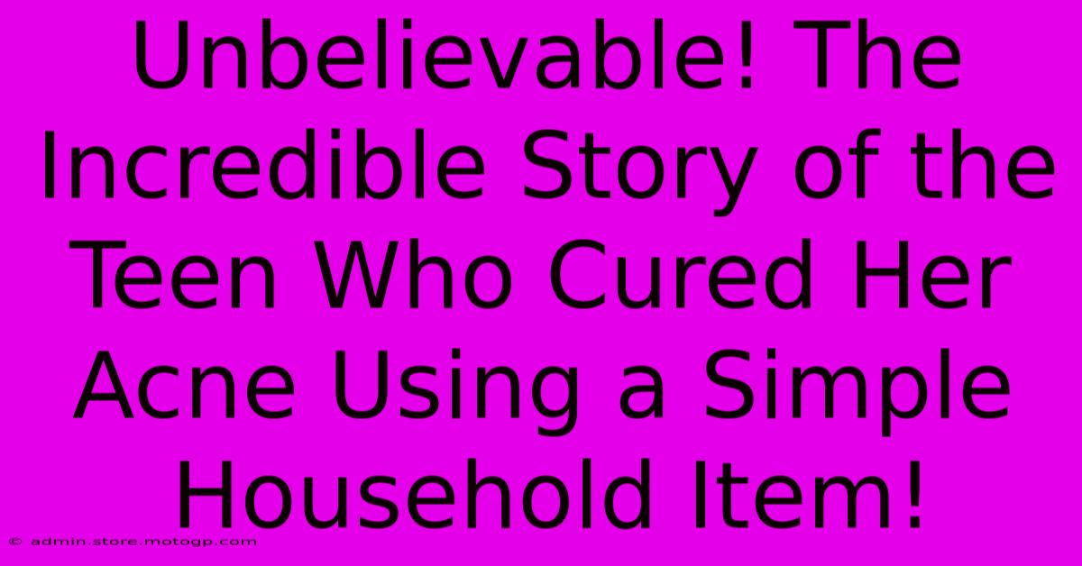 Unbelievable! The Incredible Story Of The Teen Who Cured Her Acne Using A Simple Household Item!