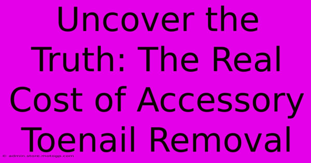 Uncover The Truth: The Real Cost Of Accessory Toenail Removal